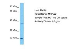 MRPL22 Rabbit anti-Human, Polyclonal, Novus Biologicals 0.1ml; Unconjugated:Antibodies,